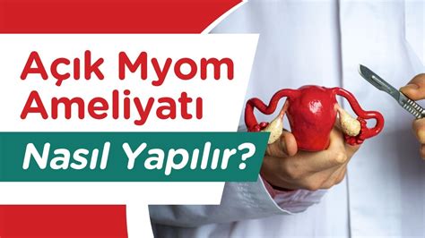 Açık Miyom Ameliyatı Nasıl Yapılır Açık Miyom Ameliyatı Öncesi Sonrası