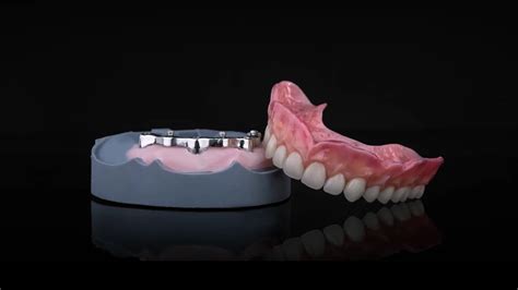 Titanium Dmls Dentures Denttech Dental Lab