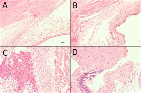 Harris Hematoxylin And Eosin Stained Representative Sections Near