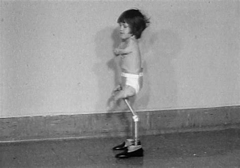 No Limits - is a film about Thalidomide, a drug made by Grünenthal which severely disabled ...