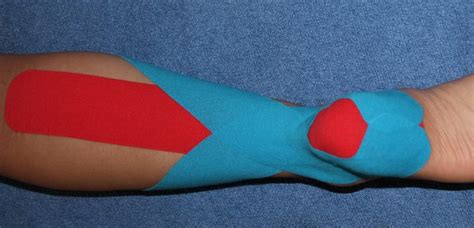 Kinesiology Taping for the Achilles Tendon｜Optimal Movement