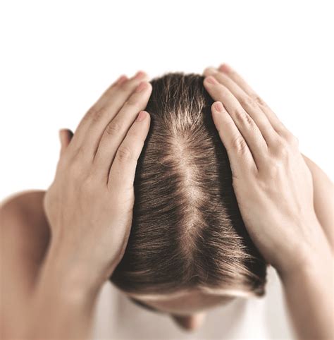 Alopecia Sau C Derea P Rului Cauze Tratamente Jurnalul De Estetica