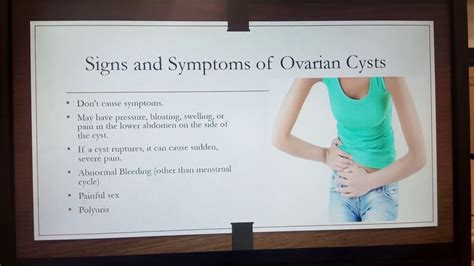 Ovarian Cyst And Fibroids Youtube