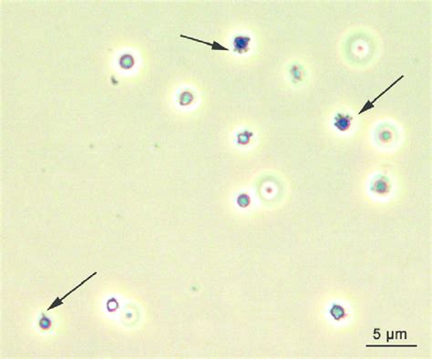 Coculture of Nanoarchaeum equitans and Ignicoccus sp. KIN4/1. Phase...