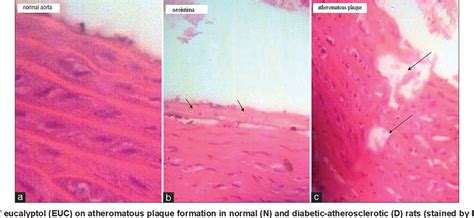 Table From Preventive Effect Of Eucalyptol On The Formation Of Aorta