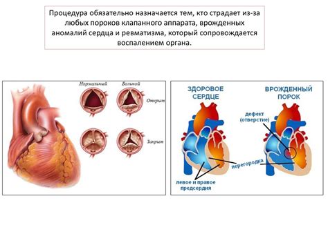 Фонокардиограф. Диагностика основных заболеваний - презентация онлайн