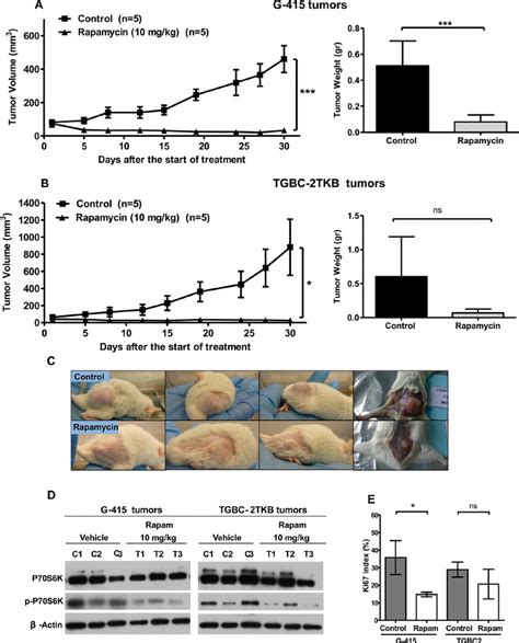 In Vivo Efficacy Of Rapamycin On Human Gallbladder Cancer Xenografts