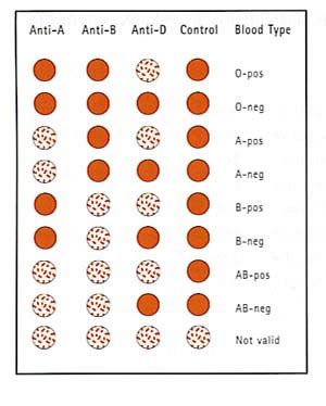 Blood Type Test Kit Group A B O And Rhesus D Home Health Uk