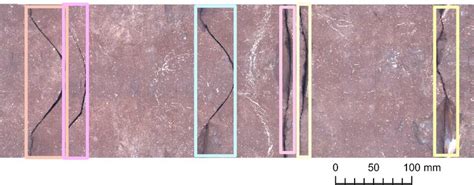 Examples Of Detected Fractures Obtained On Bo Note Image Quality