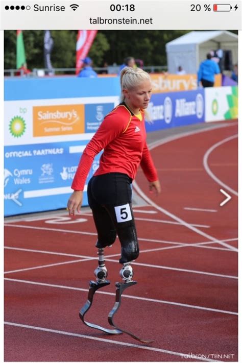 Thumbs Pro Theodorceaster Vanessa Low Lost Legs In Train Accident