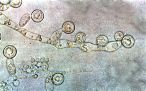 Invasive Candidiasis Clinical Lab Products