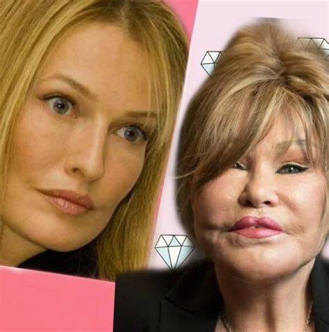 La Trasformazione Di Jocelyn Wildenstein Foto Della Splendida Bellezza