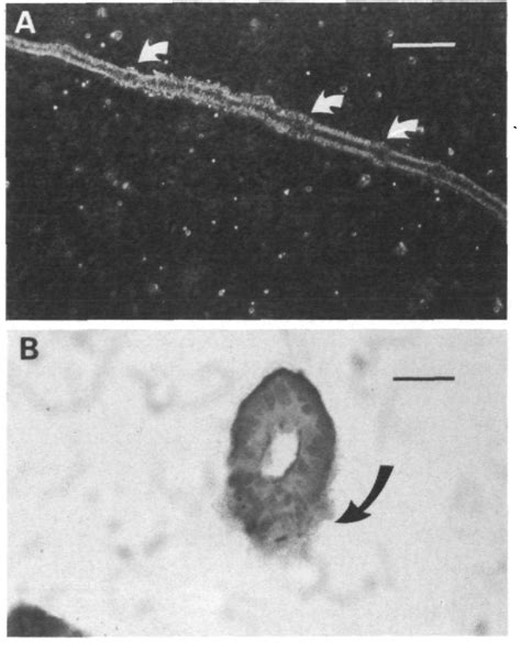 Figure 3 From A Nude Mouse Xenograft Model Of Fetal Intestine