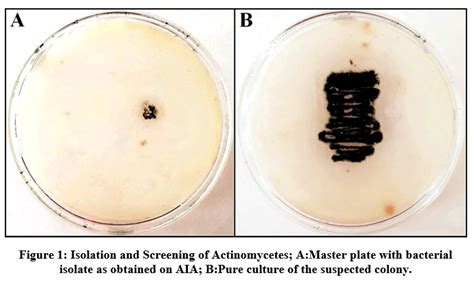 Isolation And Identification Of Pigment Producing Actinomycete