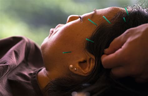 Manual Acupuncture Versus Sham Acupuncture And Usual Care For