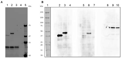 In Vitro Expression And Western Blotting Analysis Of Recombinant