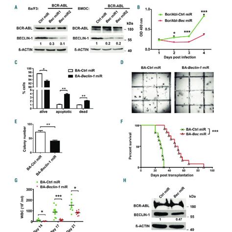 Beclin Downregulation Delays Bcr Abl Mediated Proliferation In Vitro