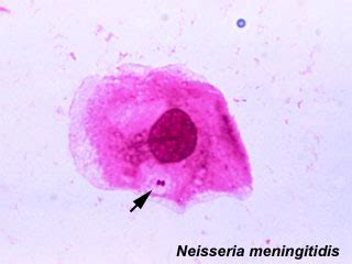 fileneisseria meningitidisjpg embryology