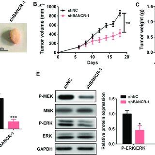 BANCR Knockdown Reduced GC Cell Resistance To Cisplatin In Vivo A C