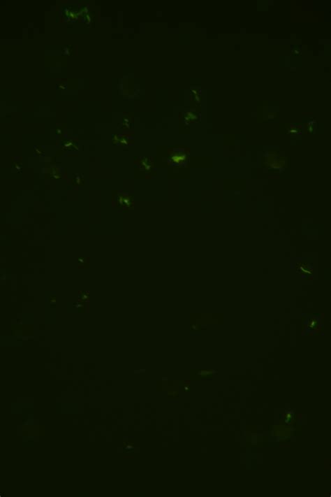 Quantify The Fluorescence Intensity Over Background Image Analysis