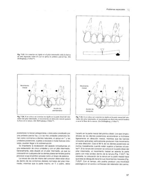 Fundamentos Esenciales En Protesis Fija