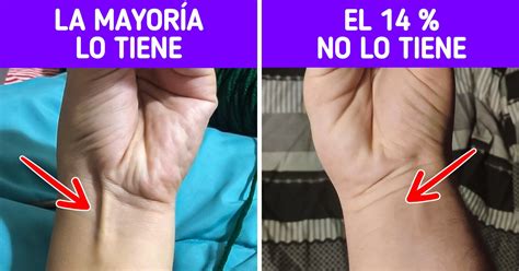 10 Extraños Rasgos Físicos Que Vuelven A Quien Los Posee La Excepción