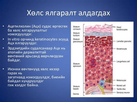 атопийн дерматит
