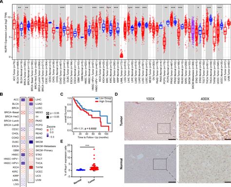 The Interplay Of Transcriptional Coregulator NUPR1 With SREBP1 Promotes