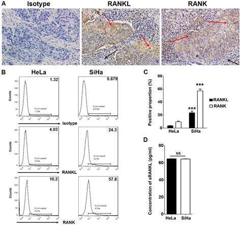 Rankl Rank Interaction Promotes The Growth Of Cervical Cancer Cells By