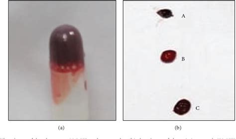 Figure 1 From Improved Thrombin Hemostat Using The Cross Linked Gelatin By Microbial