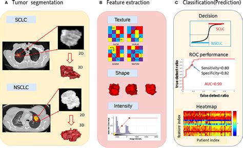 Frontiers Differentiating Peripherally Located Small Cell Lung Cancer