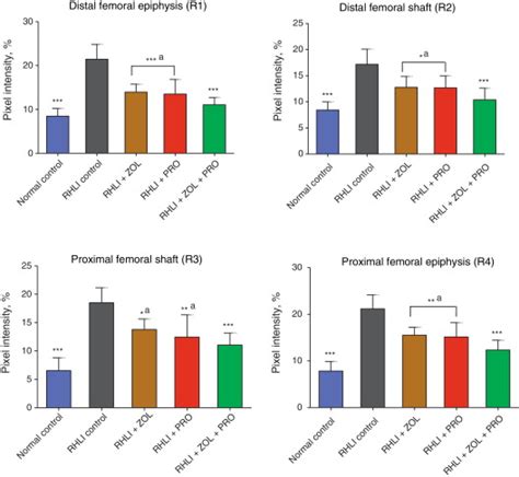 Effect Of Zoledronic Acid And Propranolol Alone Or In Combination On