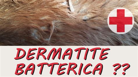 Dermatite Batterica Cause Rimedi E Prevenzione Youtube