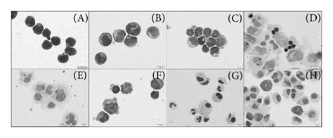 Hematopoietic Colony Forming Units And Differentiation Capacity Of