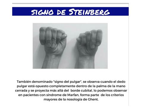 Signo De Steimberg Udocz