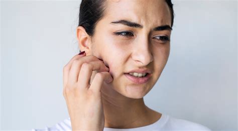 Sonnenallergie Im Gesicht Symptome Behandlung