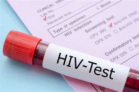 Mitos Seputar Hiv Aids Yang Kerap Rugikan Penderita Sampai Sering