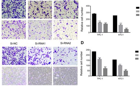 Nectin4 Regulates The Migratory And Invasive Capacities Of Papillary