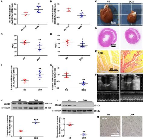 Frontiers Histone Demethylase Jmjd Mediated Doxorubicin Induced