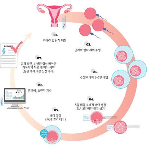 착상 전 유전 검사 난임클리닉 서울의료원 가임센터