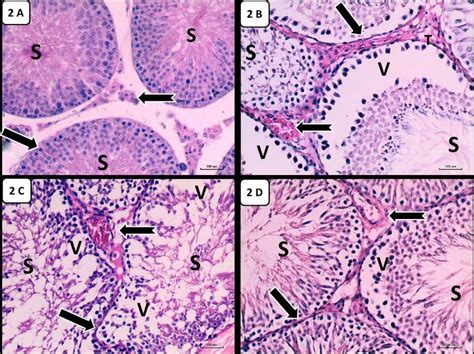 Photomicrographs Of Testicular Sections Of Higher Magnification {a