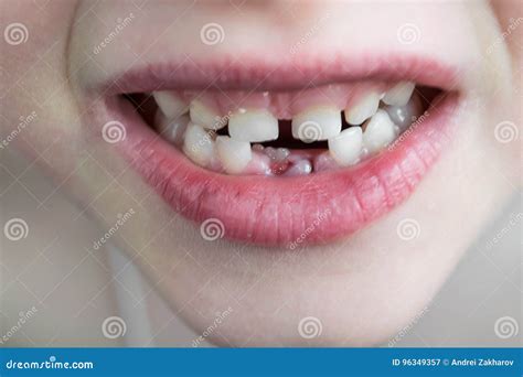 Open Mouth Child Stock Photos - Royalty Free Images