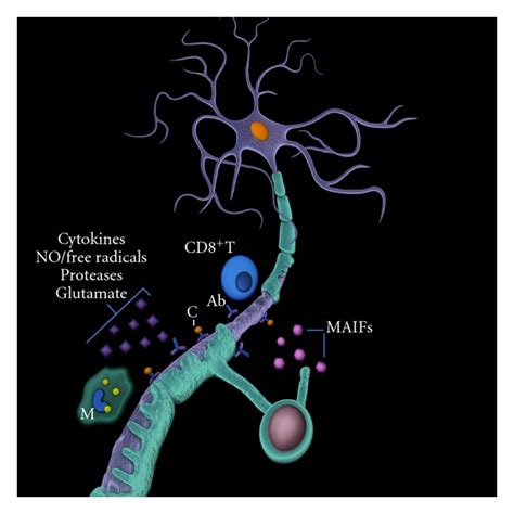 The Mechanisms Of Neuroaxonal Damage In Multiple Sclerosis Legend No