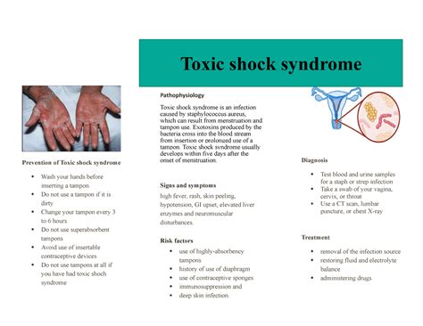 Toxic Shock Syndrome Rash On Palms