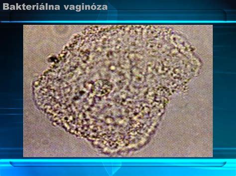 Detská gynekológia ppt stáhnout