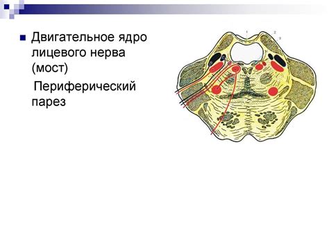 Нейропатия лицевого нерва - online presentation