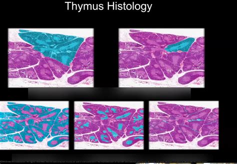 Thymus Gland Diagram Quizlet