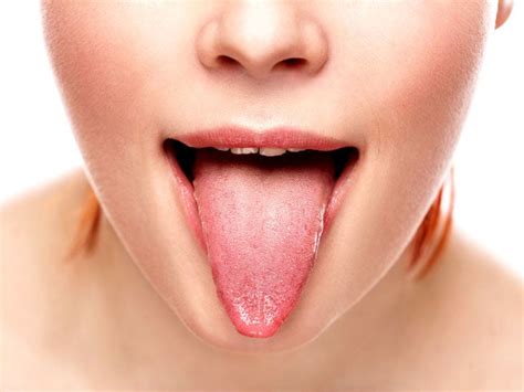 How To Get Rid Of Bumps On Tongue Lordunit28