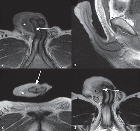 Scielo Brasil The Value Of Magnetic Resonance Imaging In The