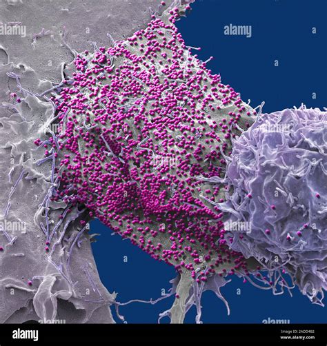 Hiv Infected T Cell Coloured Scanning Electron Micrograph Sem Of